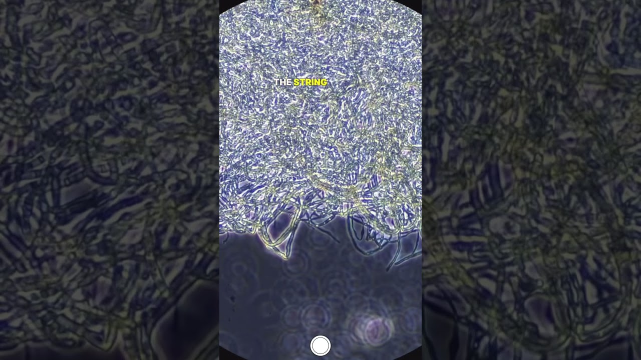 Black Mold Under Microscope 