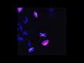 (free) loe shimmy x lucki type beat  - "zuper sonic"