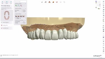 Dental System Control panel settings for full dentures