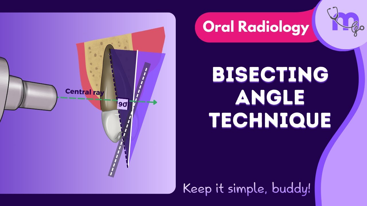 Dental Radiography Bisecting Angle Technique at Patrick Ruppert blog