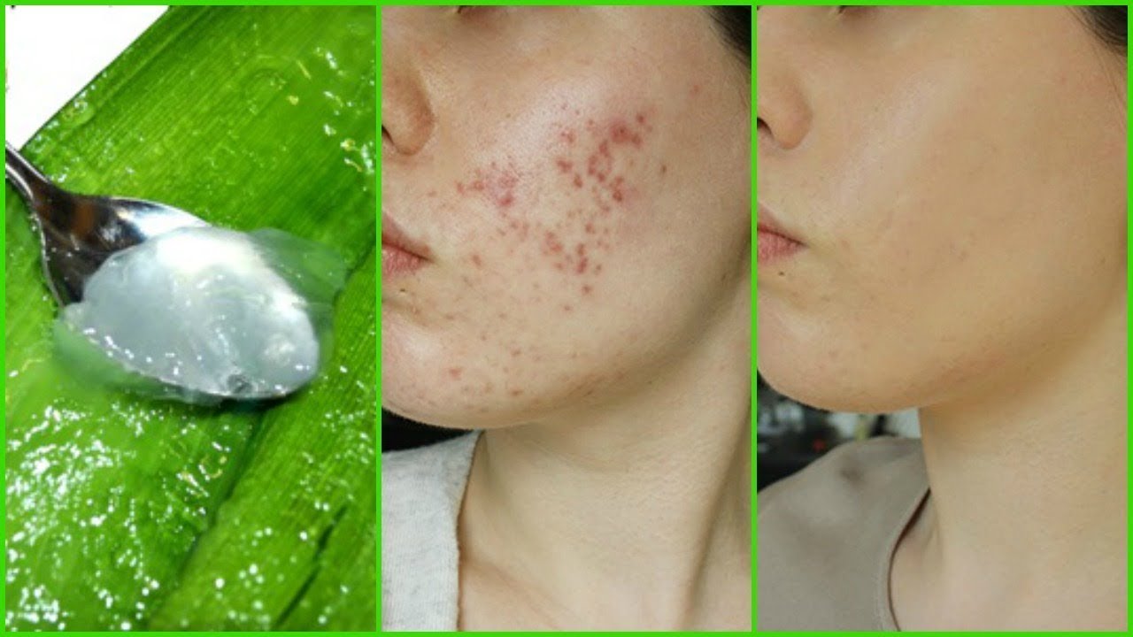 What Night Is Vera On Itv What Night Is Vera On Itv