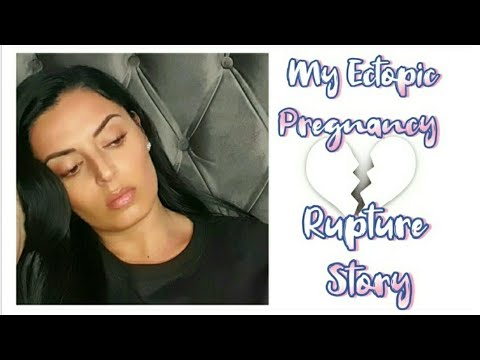 MY ECTOPIC PREGNANCY STORY  SYMPTOMS   RUPTURED TUBE  SURGERY