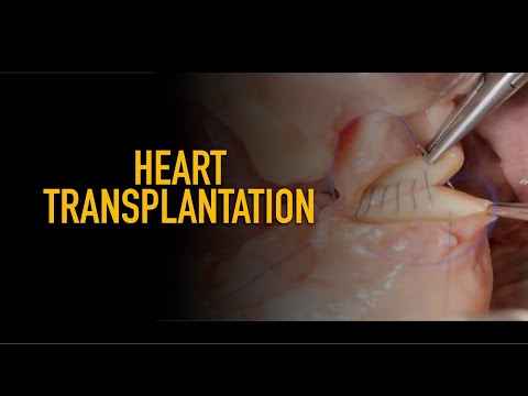 HEART TRANSPLANTATION BICAVAL TECHNIQUE/ТРАНСПЛАНТАЦИЯ СЕРДЦА БИКАВАЛЬНАЯ ТЕХНИКА (ПЕРЕСАДКА СЕРДЦА)