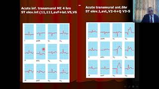 Acute Coronary Syndromes(ACS) Part 2