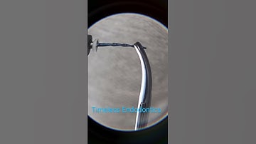 Here is the 2nd video of OTR MOTION and lower torque and speed, so how the file free itself.