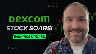 Dexcom Stock Soars After Earnings! Updates on $DXCM!