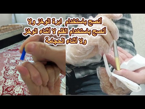 قلم الحجامة لا ننصح باستخدامه لا لوخز الاصابع أثناء الرقية ولا للحجامة بدلا من المشرط