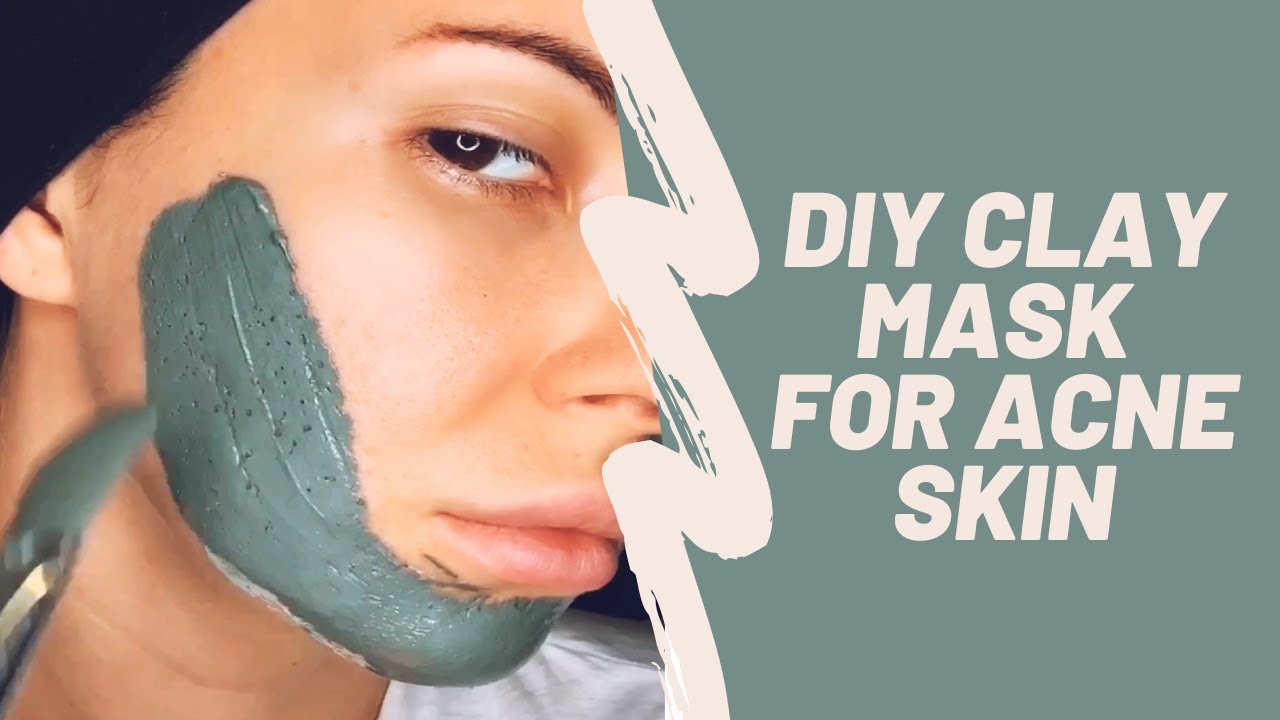 BEST HOMEMADE MASK FOR CLEAR SKIN! DIY Clay Mask For Acne Skin YouTube