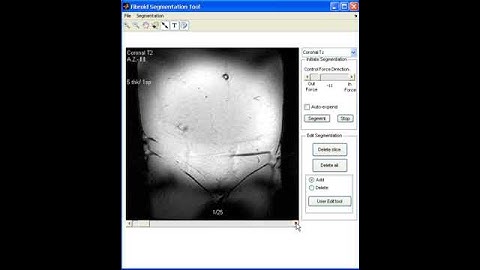 Segmentation tool demonstration