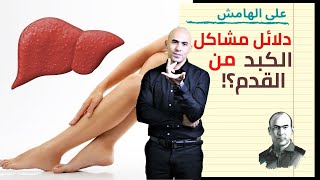 سبعة علامات بقدمك تخبرك بوجود مشاكل بالكبد | على الهامش