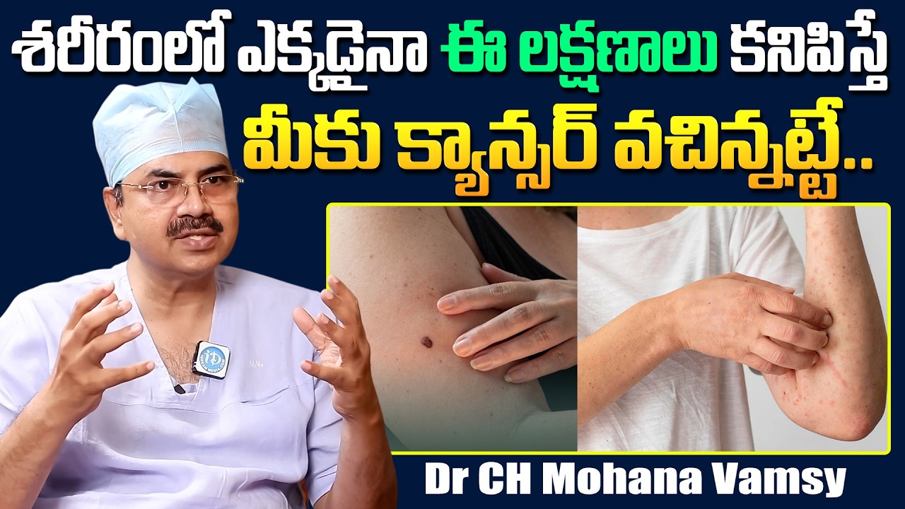 మీకు ఈ లక్షణాలు కనిపిస్తే క్యాన్సర్ వచిన్నట్టే.. | Cancer Symptoms | Dr Mohana Vamsy | iDream