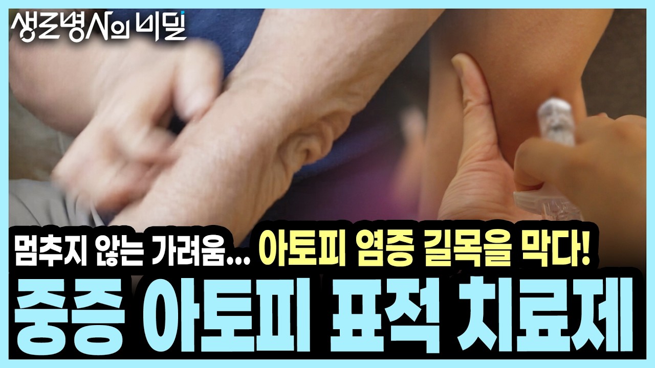 [본방종합] 생물학적 제제부터 경구용 JAK 억제제까지! 참기 힘든 가려움 원인과 표적 치료제 효과 총정리 I KBS 생로병사의 비밀 20260812 방송
