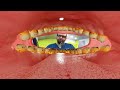 Smile Engineers dental Center ( VR ) Version Arabic