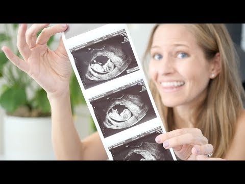 vegan-pregnancy-must-haves-(first-trimester!)