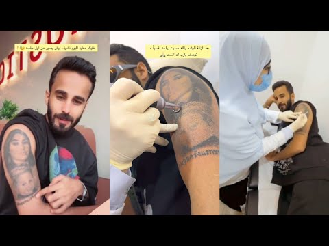 عشان ابوه وامه قرر يشيل الوشم من الالم يلوم زوجته ليش وجهك كبير ام هاني حلواني