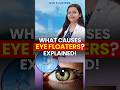 Eye Floaters: Causes, Symptoms &amp; When to Worry
