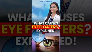 Eye Floaters: Causes, Symptoms &amp; When to Worry
