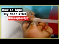 How to tape my nose after rhinoplasty?