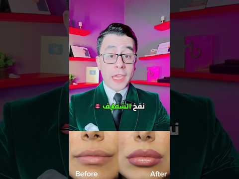 افضل وصفة طبيعية لنفخ وتكبير الشفايف