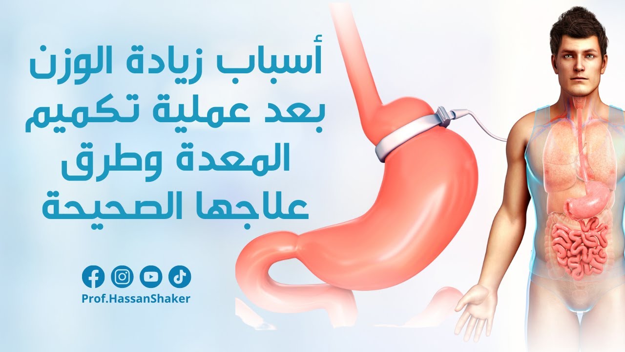 أسباب زيادة الوزن بعد عملية تكميم المعدة وطرق علاجها الصحيحة
