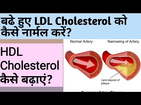 बढे हुए LDL cholesterol को कैसे normal करे ? | HDL cholesterol को कैसे बढ़ाये ?