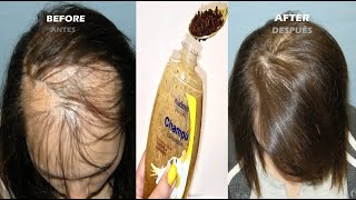 Tratamientos para el cabello maltratado (Recamier, Loreal, Bed Head, Mystic Divine, Schwarzkopf)