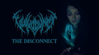 Vulvodynia - The Disconnect