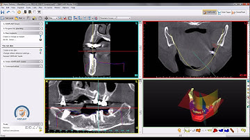 2. Visualization basics in SimPlant