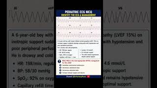 Pediatric MCQ series | ECG Challenge ⚡Identify the Rhythm & Initial Management | #ecg #mcq #neetpg