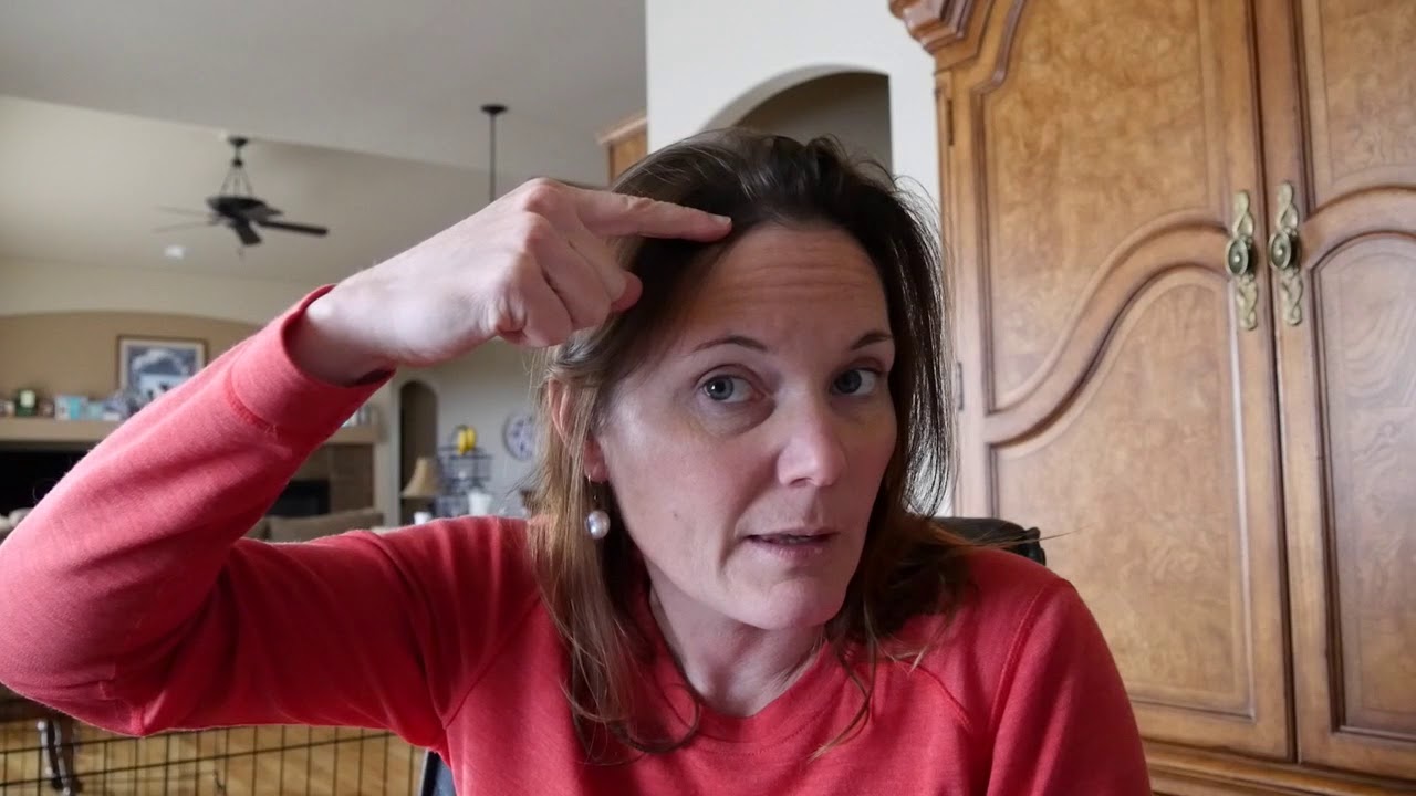 What is an STA MCA bypass brain surgery in Layman's terms