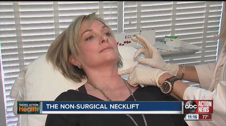 The non-surgical necklift - DayDayNews