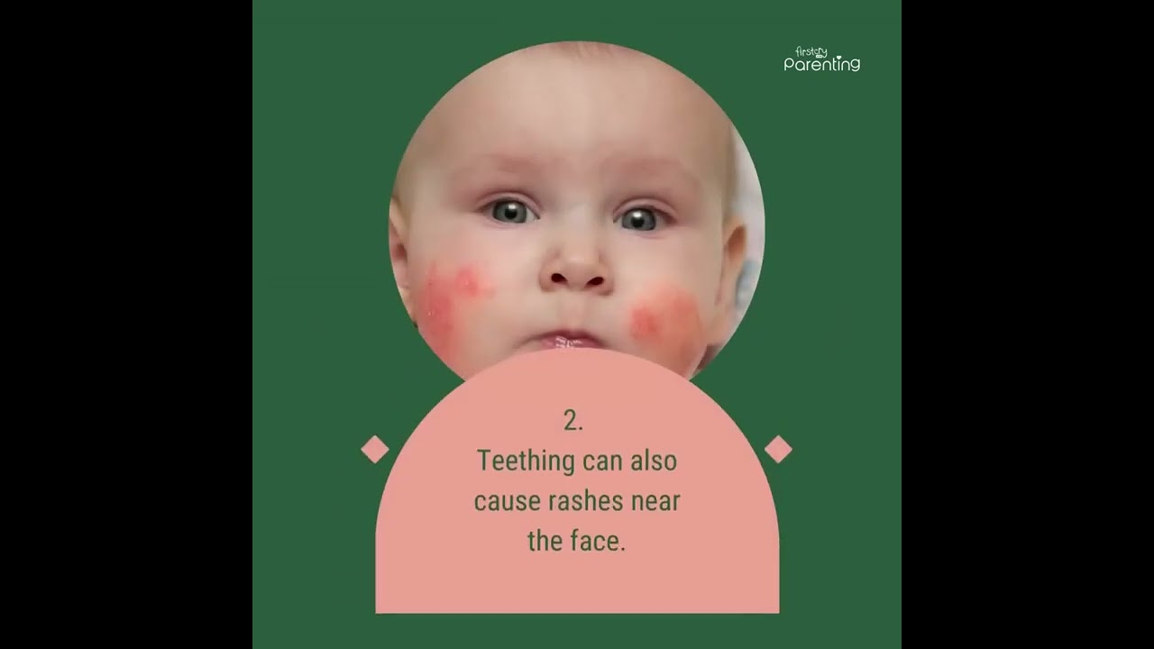 Is Your Baby Teething - Know the Signs and Remedies