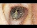 【耳掃除】#153 〜音量はミュート必須!?粘着綿棒・撮れ高⭕️