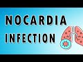 Nocardia Infection