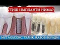 Тиш импланти нима? Брекет нима? Зарари борми? Тўлиқ маълумотга эга бўлинг