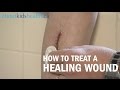 How to care for a healing wound