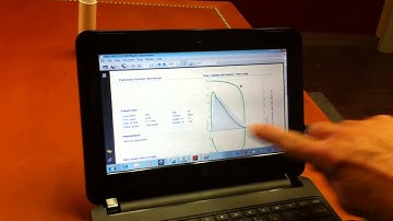 Quick Guide: MIR winspiroExpress how to download and print test results