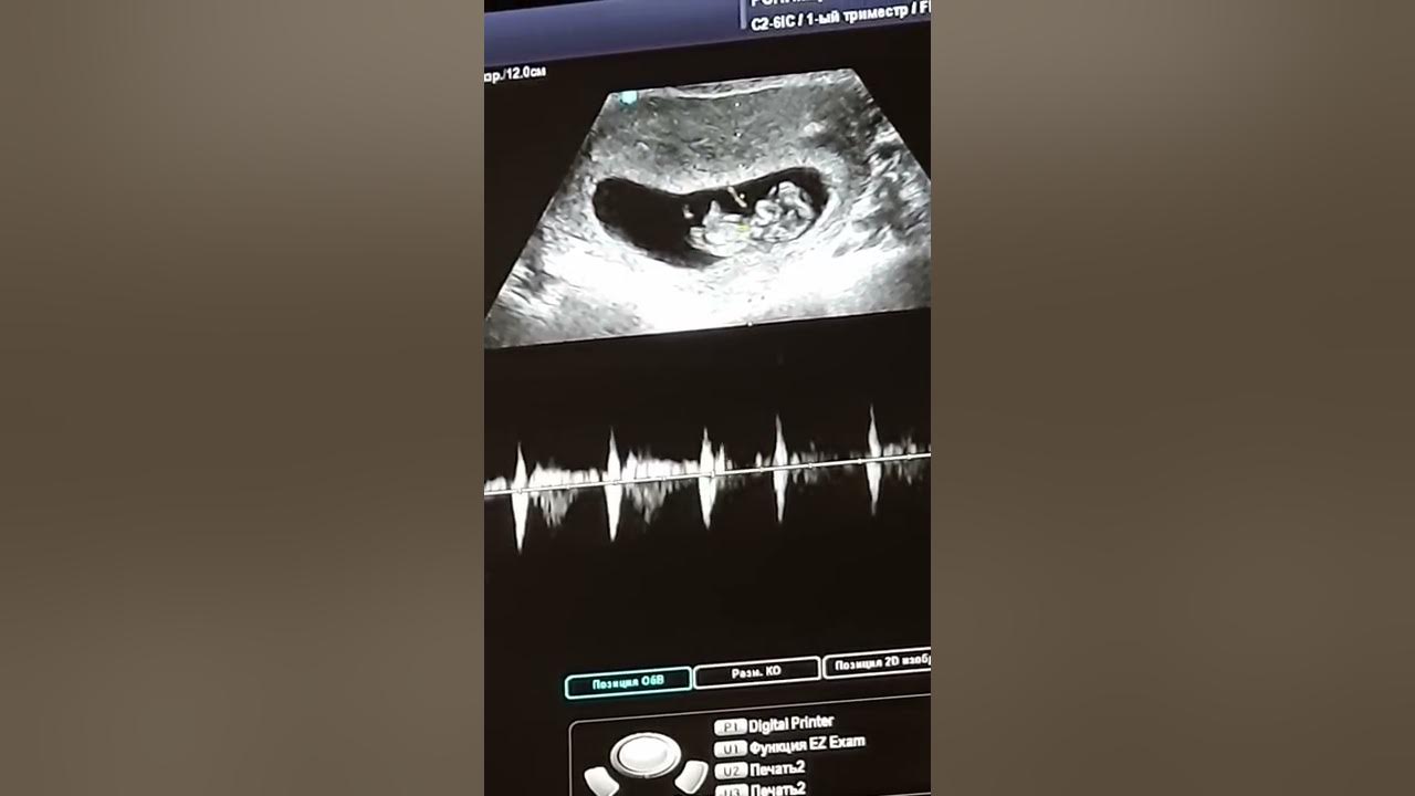 Volnovakada jinsiy aloqada bolgan qizlar Peter Vudman Sankt-Peterburgda