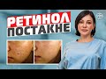 Как Использовать Ретинол Правильно?! Кому можно и нельзя?