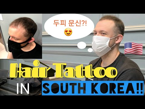 Awesome Scalp Micropigmentation (SMP) Treatment In South Korea