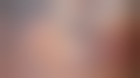 ROBOTIC SINGLE PORT CHOLECYSTECTOMY