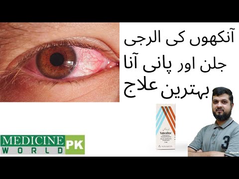 Tobradex Eye drops (Tobramycin l Dexamethasone) l Uses l Dose l Alternate brands