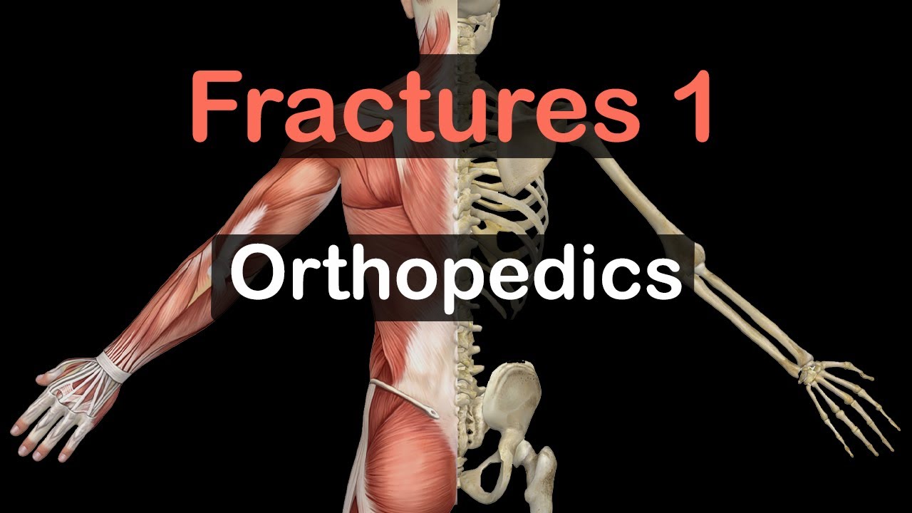 Orthopedics: Fractures 1 - YouTube