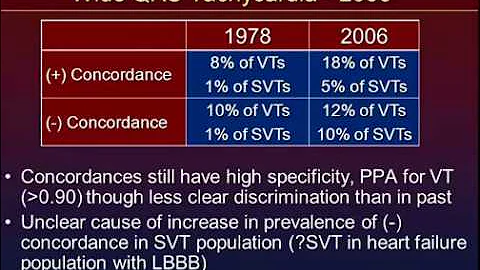Wide QRS Complex Tachycardia: Something Old, Something New