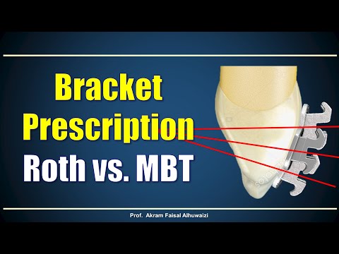 Using Roth and  MBT brackets