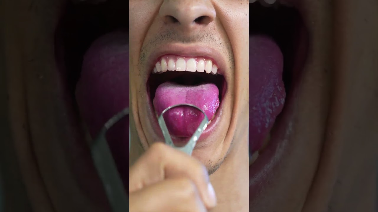 whiter teeth at home!