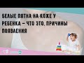 Белые пятна на коже у ребенка — что это, причины появления