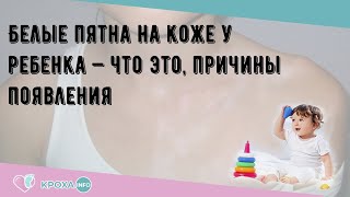 Белые пятна на коже у ребенка — что это, причины появления