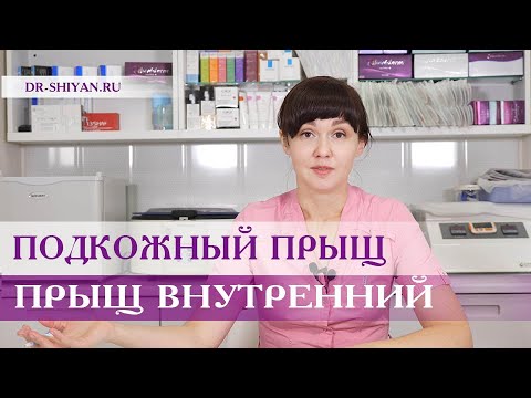 Подкожный прыщ, внутренний прыщ