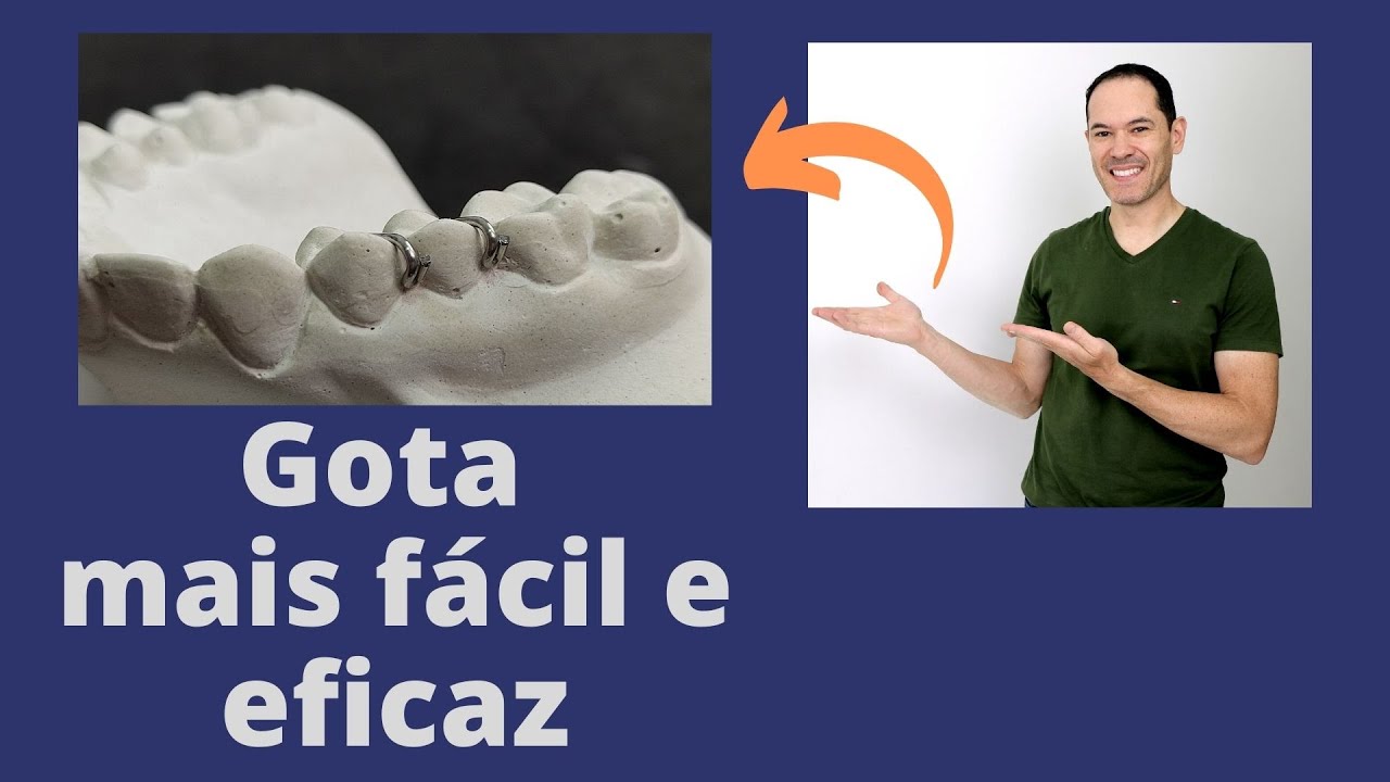 Grampo Gota- O mais usado